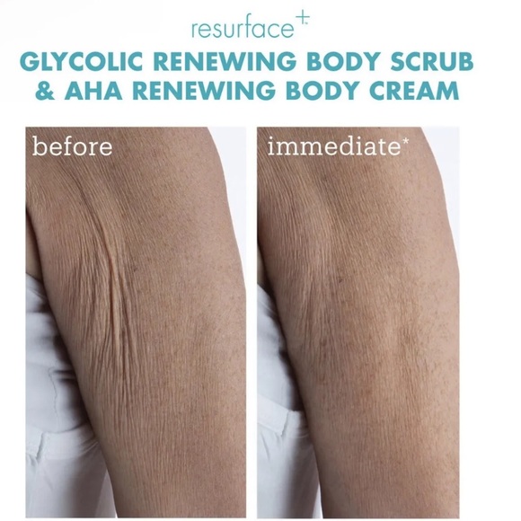 New, Skinfix Resurface+ AHA/BHA Renewing Body Cream 296 mL / 10 oz. - Picture 3 of 10